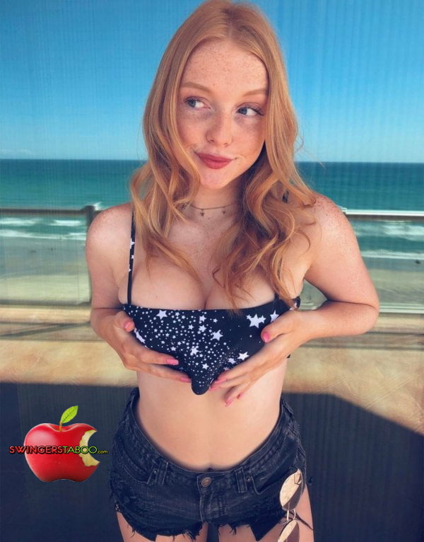 Freckles